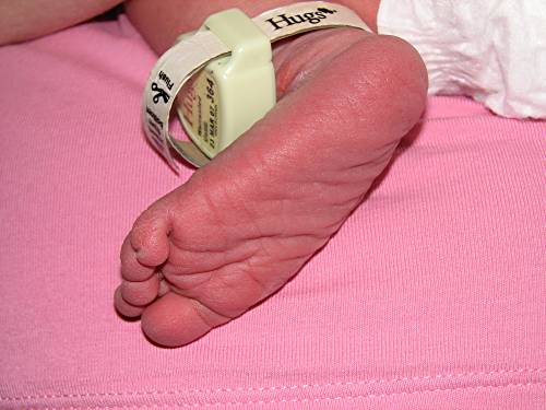 Newborn foot